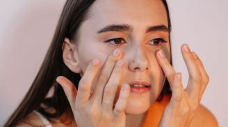 3 cách khắc phục quầng thâm mắt giúp chị em trẻ ra hẳn vài tuổi
