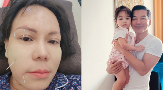 Showbiz 6/4: Việt Hương bị méo một bên mặt, Trần Bảo Sơn xác nhận chia tay mẹ của con gái thứ 2