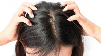 4 tác hại khôn lường với da đầu nếu bạn quên gội đầu sau mỗi lần tập luyện