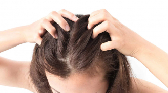 6 giải pháp cấp cứu tình trạng da đầu có mùi hôi gây khó chịu