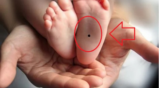 Trẻ sinh ra có nốt ruồi ở 3 vị trí này: Tương lai tươi sáng, sớm thành tài cha mẹ hưởng phước thơm