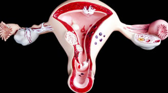 Phụ nữ có tử cung khỏe mạnh thường có biểu hiện này: Nếu bạn cũng có xin chúc mừng