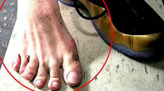 Người xưa nói: 'Ngón chân thứ hai dài hơn ngón cái, lớn lên không hiếu thuận', có đúng không?