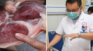 Phần thịt lợn chứa đầy mầm bệnh mà nhiều người Việt cực thích, phiên chợ nào cũng mua