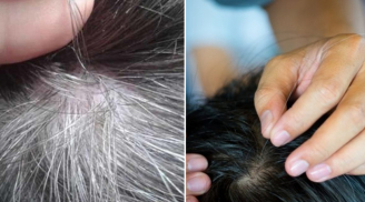 Lý do không nên nhổ tóc bạc: Có 3 cái hại lớn, không phải ai cũng biết