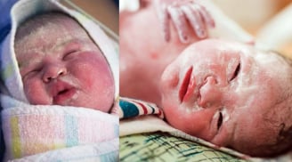 Tại sao trẻ sơ sinh có chất gây trắng phủ ngoài da, mẹ bầu có cần làm gì để con “sạch” hơn?