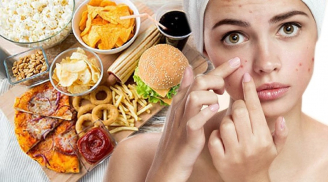 3 loại đồ ăn ăn càng nhiều mặt càng nổi mụn, nàng nên chú ý để loại bỏ khỏi thực đơn