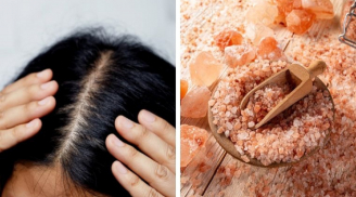 Mẹo dùng loại gia vị quen thuộc để gội đầu sạch gàu, giúp giảm tình trạng rụng tóc