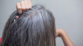 Phụ nữ tóc bạc ngày một nhiều, đừng vội nghĩ mình già, có thể là do cơ thể đang gặp phải 3 vấn đề