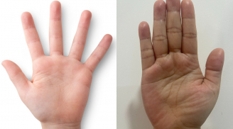 Lòng bàn tay nói lên tuổi thọ: Bác sĩ chỉ 3 đặc điểm báo hiệu người sống lâu