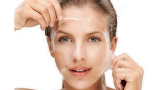 Lột da mặt để trị nám có phải là phương pháp tốt không?