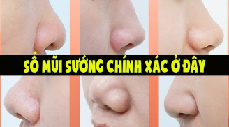 Ai có tướng mũi này tài lộc vây quanh, kiếm tiền quá dễ