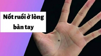 5 nốt ruồi “phú quý” trên người: Đàn ông kiếm ra tiền, đàn bà làm ra vàng, ai cũng giàu sang