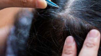 Thói quen nhổ tóc sâu gây hại như thế nào đến tóc và da đầu?