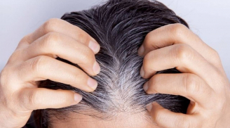 Tại sao tóc bạc sớm và có nên nhổ tóc bạc?