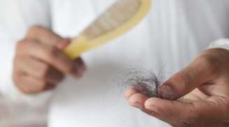 4 thói quen cơ bản để khắc phục tình trạng tóc rụng nhiều