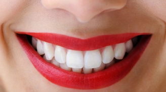 5 loại thảo mộc làm trắng răng, giúp bạn có được hơi thở thơm tho