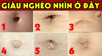Người có 3 tướng rốn này giàu sang phú quý hơn người: Ai có thật đáng chúc mừng