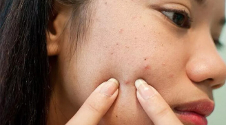 6 sai lầm phổ biến khi chăm sóc da mà bạn cần phải tránh nếu không muốn da xuống cấp