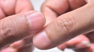 Bàn tay không có 5 đặc điểm này chứng tỏ gan khỏe mạnh, sống thọ