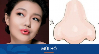 Nhìn tướng mũi 3 giây biết tương lai bạn thành đại gia hay làm công mãi mãi