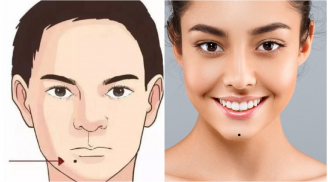 3 nốt ruồi chôn giấu tài lộc: Ai có được thật đáng chúc mừng