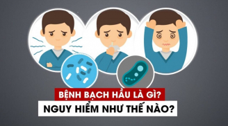 Bệnh bạch hầu có lây không, nguy hiểm thế nào?