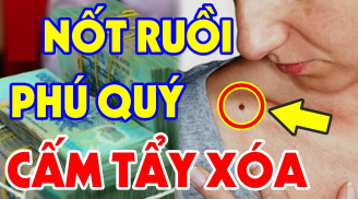 7 nốt ruồi điềm lành trên cơ thể, có 1 cái thôi cũng sướng cả đời