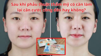 Sau khi phẫu thuật thẩm mỹ có cần làm lại căn cước công dân hay không? Rất nhiều người không biết