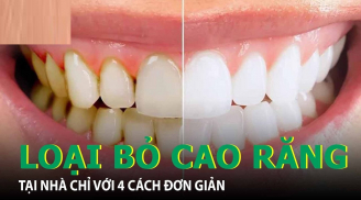 Cao răng bám đầy, vàng ố mấy chỉ cần làm cách này là bong ra hết, răng trắng khỏe