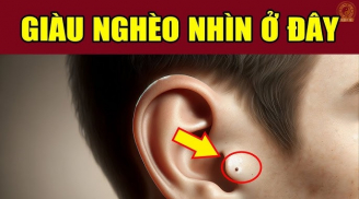 Người có nốt ruồi trên dái tai đường công danh Tiền Tài có thuận?