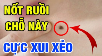 3 nốt ruồi phá của: Đặc biệt vị trí thứ nhất, hai hụt tiền bạc, bỏ ngay trước khi quá muộn