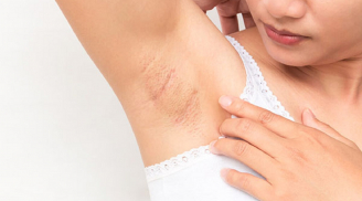 Mách nàng 7 tips đơn giản khắc phục nách bị thâm sạm, kém mịn màng