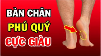 Người có 3 điểm này trên bàn chân: Không thành tỷ phú cũng là đại gia