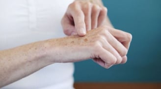 Mẹo chữa nám da tay bảo dưỡng làn da mướt mịn