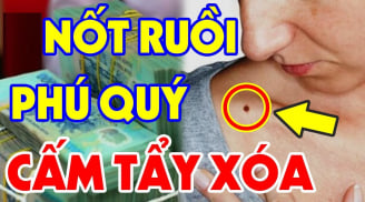 Bất kể nam hay nữ, có 6 nốt ruồi trên người quý hơn vàng, 1/6 cái thôi tiền của đề huề