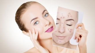 Muôn vàn lợi ích tuyệt vời của nước muối đối với làn da và mái tóc mà bạn nên biết