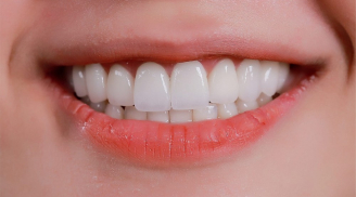 Chảy máu chân răng cảnh báo bệnh nan y: Ai thường xuyên bị nên đi kiểm tra sớm