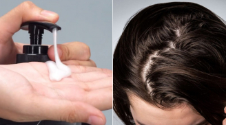 Trộn thứ này vào dầu gội, tóc lâu bết, giảm rụng, lúc nào cũng bồng bềnh