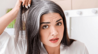Vì sao sau tuổi 40 tóc bạc nhiều và nhanh?