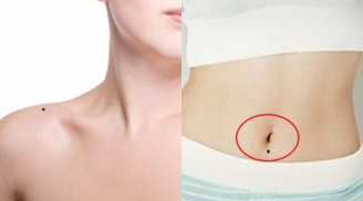 6 nốt ruồi mang lại may mắn và phúc đức theo nhân tướng học
