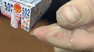 Keo 502 đổ vào tay: Nhỏ ngay 1 giọt này vào gỡ ra nhẹ tênh, không để lại sẹo