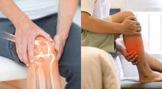 Người bị thiếu canxi hay gặp 7 dấu hiệu này, kiểm tra ngay xem mình có không