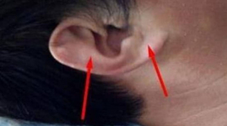 Các cụ dặn dò: 'Có lông mọc ở 4 nơi này thì đừng nhổ bỏ, càng nhiều lông càng có phúc'
