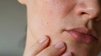 Ăn gì để có được làn da hoàn hảo dù tuổi tác dần tăng?