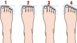Phụ nữ có những đặc điểm này ở chân càng về già càng may mắn, tha hồ hưởng lộc