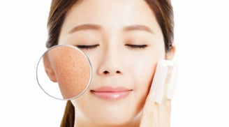 Mẹo giúp se khít lỗ chân lông da mặt hiệu quả, đơn giản