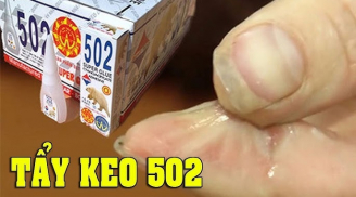 Chẳng may bị dính keo 502 vào tay, mách bạn cách gỡ đơn giản, không lo bỏng rát