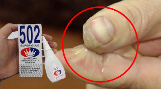 Keo 502 dính vào tay đừng lau hay rửa nước, nhỏ giọt này là gỡ được ngay, không bỏng rách da