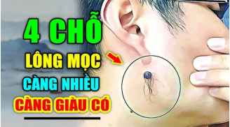 Lông mọc chỗ này điềm báo phát tài: Ngồi không cũng giàu, ai có thật đáng chúc mừng